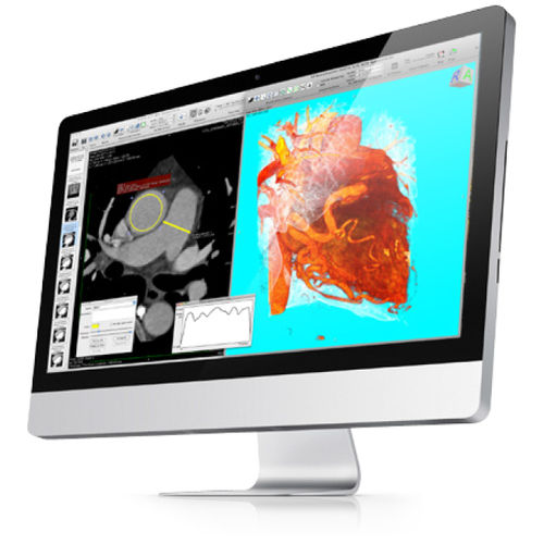 Software SPECT - Pixmeo SARL - visualizador / de pós-processamento / de importação