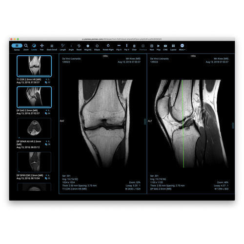 Software em nuvem - Pixmeo SARL - de compartilhamento / de segurança / médico-hospitalar