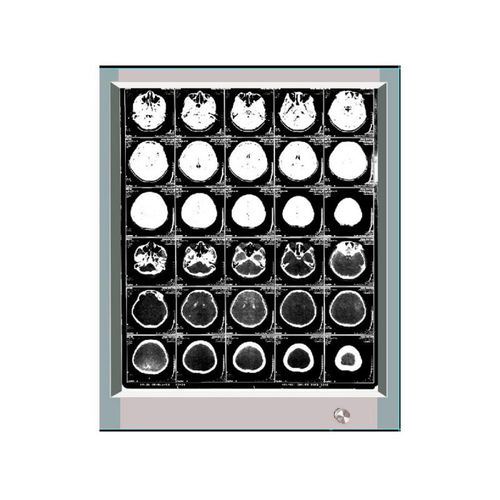 Negatoscópio 1 corpo - GP1001A - Bellamoon Medical - LED