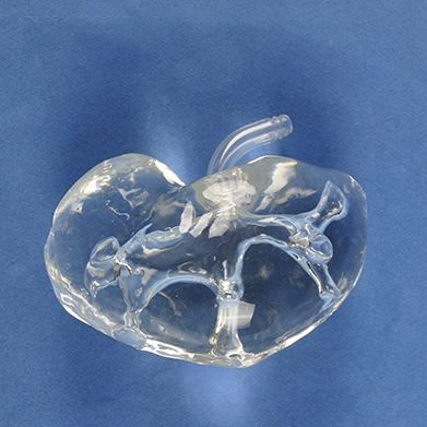 Modelo de pelve - Trando 3D Medical Technology - de rim / de ureter / de cirurgia