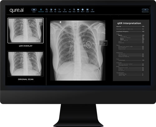 Software de criação de laudos - qXR - Qure.ai - de interpretação / de detecção / para radiologia