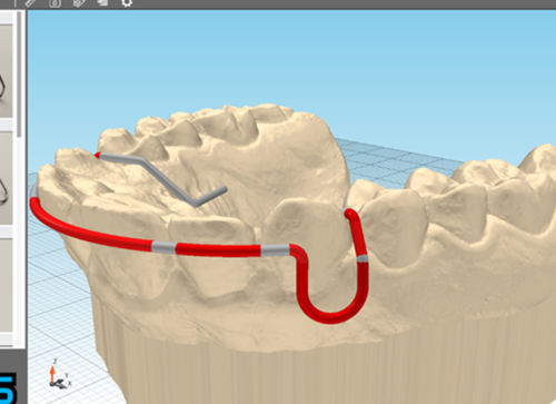 Software de fabricação - JawDraw® - Advanced Orthodontic Solutions  - odontológico