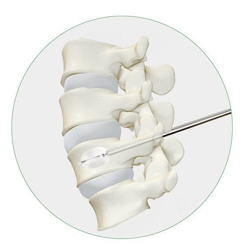Dispositivo para reparação de fraturas vertebrais com balão - Princeton Medical Scientific - para cifoplastia percutânea