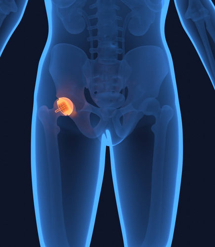Software de planejamento - DataArt GmbH - médico-hospitalar / cirúrgico / para ortopedia