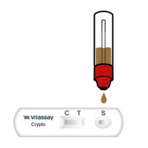 Teste rápido para doenças gastrointestinais - VITASSAY HEALTHCARE S.L. - de antígeno / de Cryptosporidium / de fezes