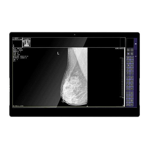 Monitor médico - IVS-8MP - Shenzhen Juding Medical Equipment Co.,Ltd. - de diagnóstico / para exames de imagem / para mamografia