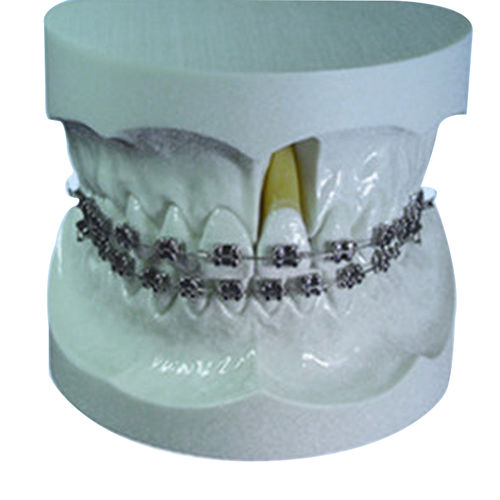 Modelo anatômico de dentição - UM-S11 - Tangshan UMG Medical Instrument - para ortodontia / de demonstração