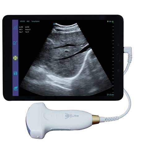 Aparelho de ultrassom de bolso - UC5-2S - Beijing iTrason Technologies - ginecológico e obstétrico / abdominal e pélvico / urológico
