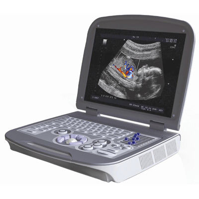 Aparelho de ultrassom portátil - 6600PLUS - Mianyang Sonic Electronic - geral / em preto e branco / com Doppler colorido