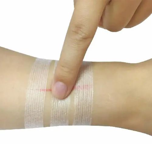 Curativo ponto falso em tecido não tecido (TNT) - Zhejiang Perfectseal - hipoalergênico