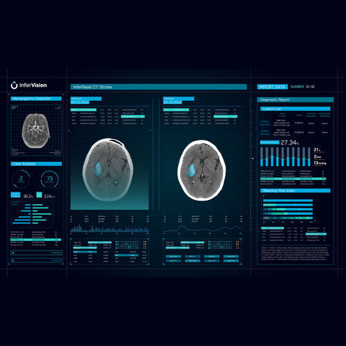 Software de gestão de alertas - CT Stroke - Beijing Infervision Technology Co. Ltd. - de tratamento / para identificação de variantes / médico-hospitalar