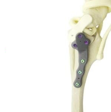 Placa de compressão óssea veterinária para pata - TPLO - Anhui Bailu Small Animal Orthopedic Instrument