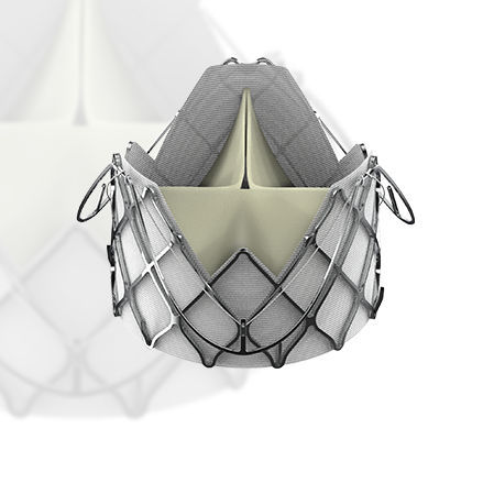 Bioprótese valvar aórtica - J-Valve™ - Suzhou Jiecheng Medical Technology - de tecido porcino / em nitinol / sem sutura