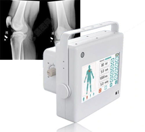 Gerador de raios X para radiografia geral - FTLF10 - Fatali Medical - portátil / com painel de controle / com bateria