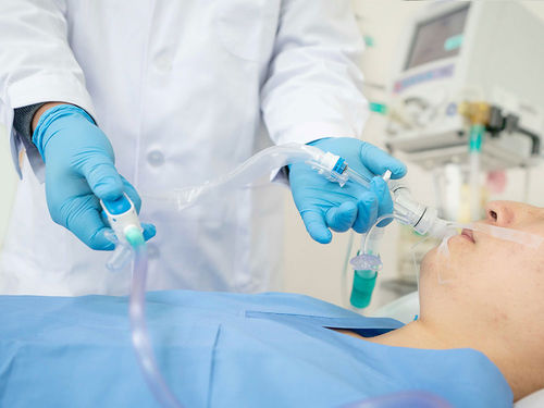 Sistema de sucção para intubação traqueal - H206400 - Ningbo Xinwell Medical Technology - para traqueostomia