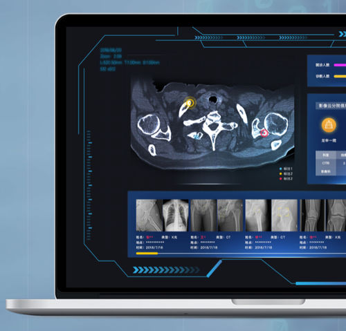 PACS com computação em nuvem - NovaCloud® - Huiying Medical Technology (Beijing) Co., Ltd. - para área médica