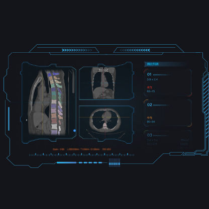 Aplicativo Web de visualização - Dr. Turing® - Huiying Medical Technology (Beijing) Co., Ltd. - de análise / médico-hospitalar / para TC