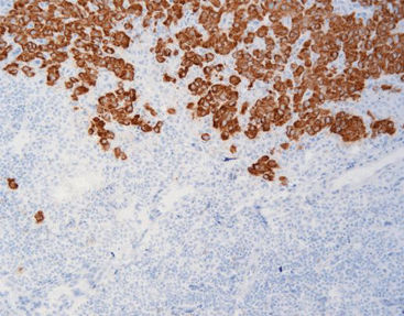 Reagente anticorpos - FCM0200 - Celnovte Biotechnology Co., Ltd. - para imunohistoquímica / de proteínas / extraído de ratos