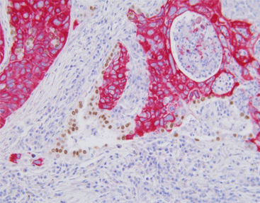 Kit de reagentes solução de coloração - SD8103 - Celnovte Biotechnology Co., Ltd. - de tecidos / para imunohistoquímica