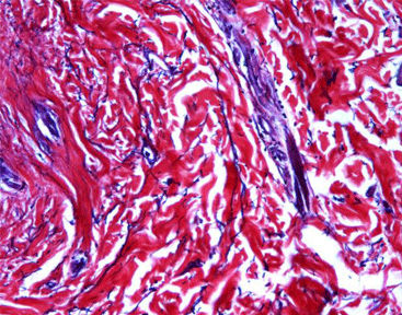 Kit de reagentes corante - Celnovte Biotechnology Co., Ltd. - de colágeno / para histologia