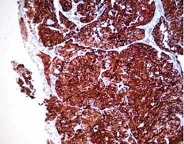 Reagente corante - SD8002 - Celnovte Biotechnology Co., Ltd. - para imunohistoquímica / de fosfatase alcalina / cromogênico
