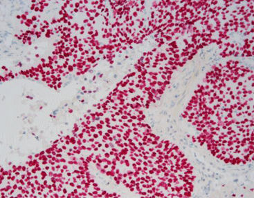 Reagente corante - SD8003 - Celnovte Biotechnology Co., Ltd. - de tecidos / para imunohistoquímica / de fosfatase alcalina