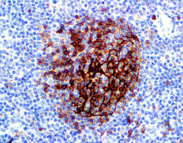 Reagente solução de coloração - CCM-0483 - Celnovte Biotechnology Co., Ltd. - anticorpos / corante / de tecidos