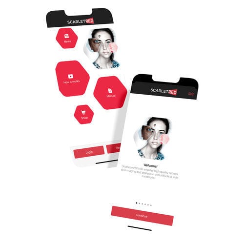 Aplicativo para Android de controle - Scarletred®Vision - SCARLETRED Holding GmbH - de captura / de calibração / para dermatologia