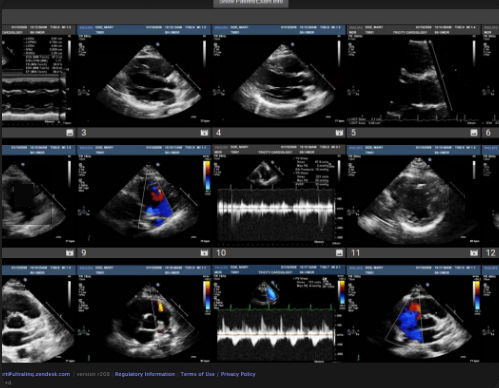 PACS para exames de imagem - Cardiology - UltraLinq