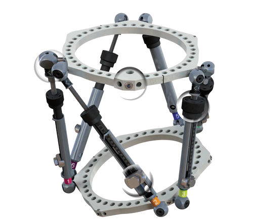Fixador externo para tíbia - Wuxi Betta Medical Technology - para fêmur / para tornozelo / circular
