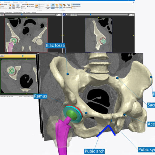 Software de análise de imagens - Simpleware ScanIP  - Synopsys Simpleware Product Group - de visualização 3D / visualizador DICOM / de diagnóstico