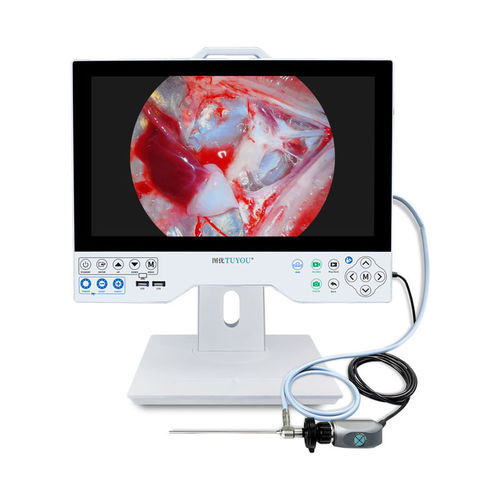 Câmera para endoscópio - TU-15LSD101B - Shenzhen Tuyou Medical Imaging Co., Ltd.​ - para inspeção / digital / VGA