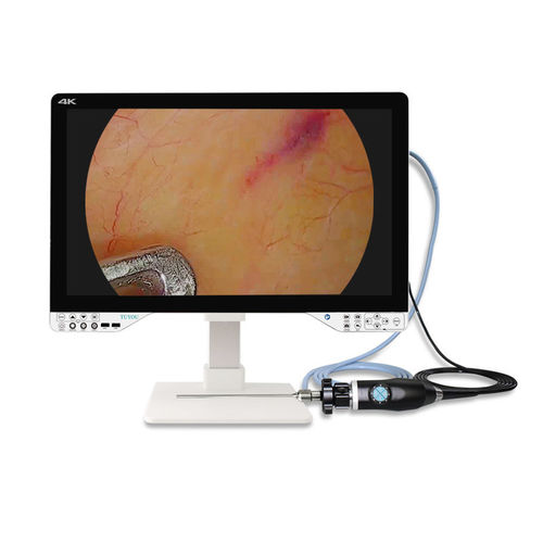Câmera para endoscópio - TU-27LSD1A - Shenzhen Tuyou Medical Imaging Co., Ltd.​ - cirúrgica / digital / de alta definição
