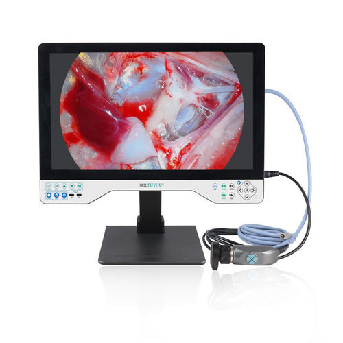 Câmera para endoscópio - TU-24LSD101B - Shenzhen Tuyou Medical Imaging Co., Ltd.​ - hospitalar / digital / VGA