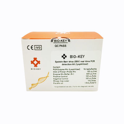 Kit de teste para doenças infecciosas - BIK-QL-H0017 - Biokey Health - do vírus Epstein-Barr / de soro / de plasma