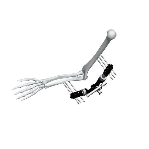 Fixador externo para cotovelo - FE5M-D040 - Chongqing FWS Medical Device - tubular