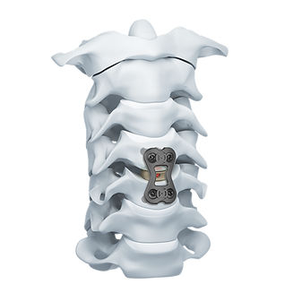 Placa para artrodese cervical - CAP  - Mediox - 1 nível