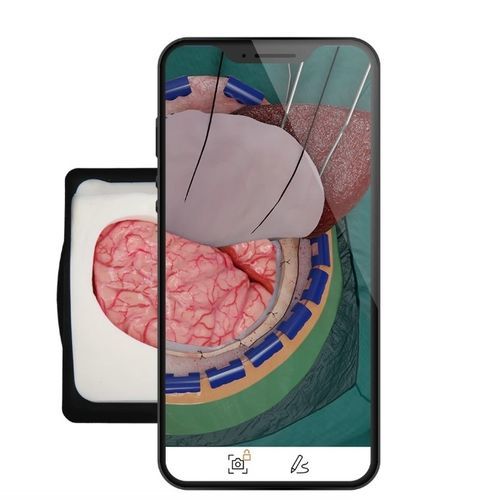 Aplicativo móvel de planejamento - UpSurgeOn - para treinamento / médico-hospitalar / para neurocirurgia