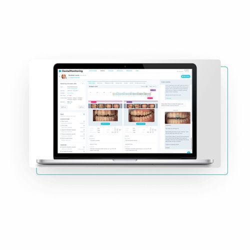 Plataforma de IA odontológica - Dental Monitoring - de análise de imagens / de tratamento / de captura