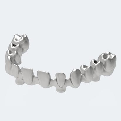 Ponte dentária em PMMA - NEW ANCORVIS S.r.l - em cerâmica / em zircônia / para dentes posteriores