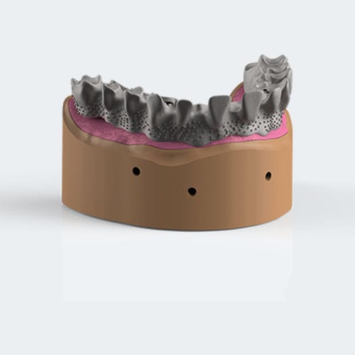 Prótese dentária em titânio - DUO LINE - NEW ANCORVIS S.r.l - em cromo-cobalto / para dentes anteriores / removível