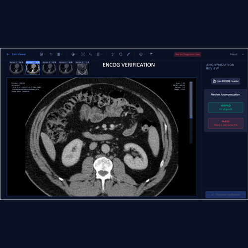 Aplicativo Web de gestão de dados - ENCOG™ - Enlitic - de rastreamento de dados / médico-hospitalar / para TC
