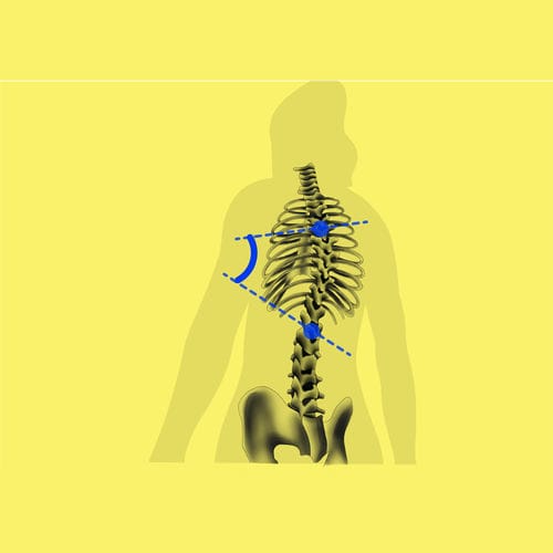 Software de interpretação - BoneMetrics - Gleamer - de normalização / médico-hospitalar / clínico