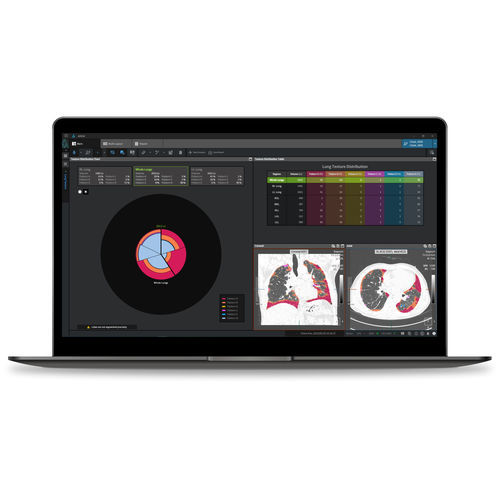 Software médico-hospitalar - Coreline - de análise / de criação de laudos / de interpretação