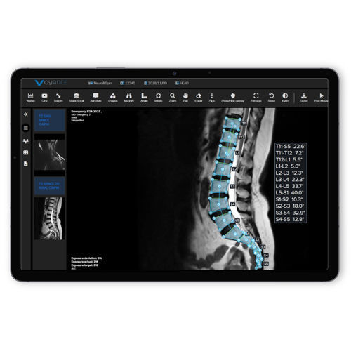 PACS para exames de imagem - vpax.ai - voyance - baseado em tecnologia Web