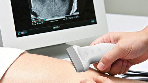 Aparelho de ultrassom móvel - ariemedi - geral / 3D/4D