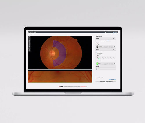 Módulo de software de medição - UMI AVR - ULMA Medical Technologies - para oftalmologia / de retina / de artéria