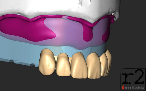 Software de design - BiteReg  - Dentona AG - de importação / de impressão 3D / de modelagem