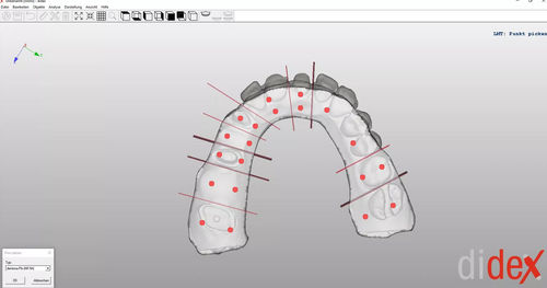 Software de captura - didex  - Dentona AG - de impressão 3D / de modelagem / de fabricação