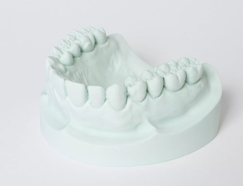 Material dentário de gesso - hydro-stone® 200 - Dentona AG - em pedra / de fundição / para confecção de modelos